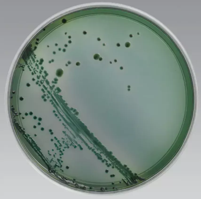 Thermo Scientific TCBS Agar 10/Pack – Medex Supply